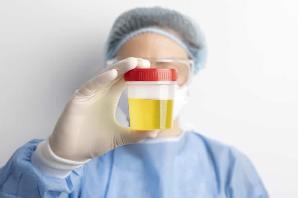 EPP : Délivrance sans ordonnance des antibiotiques en officine dans les cas de cystites aiguës se présentant spontanément au comptoir