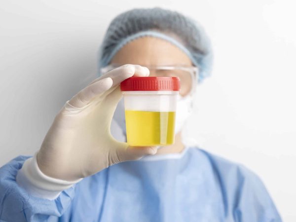 EPP : Délivrance sans ordonnance des antibiotiques en officine dans les cas de cystites aiguës se présentant spontanément au comptoir